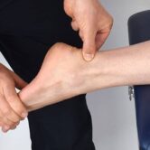 yCFxqPkoRtWiBjKc7qP9_achilles_tendinopathy