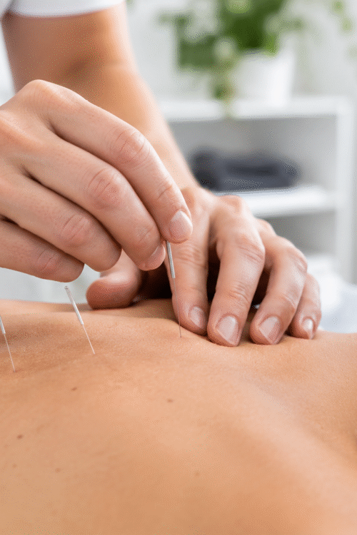 Precision Dry Needling in a Modern Clinic